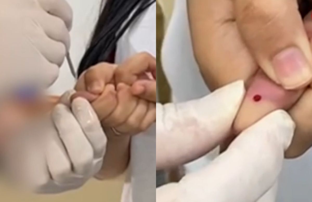 43 alunos participaram de atividade prática de coleta de sangue com a mesma agulha